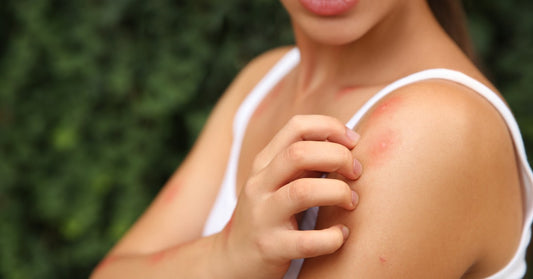 A woman wearing a white tank top is grimacing while itching several red bug bites on her left shoulder.