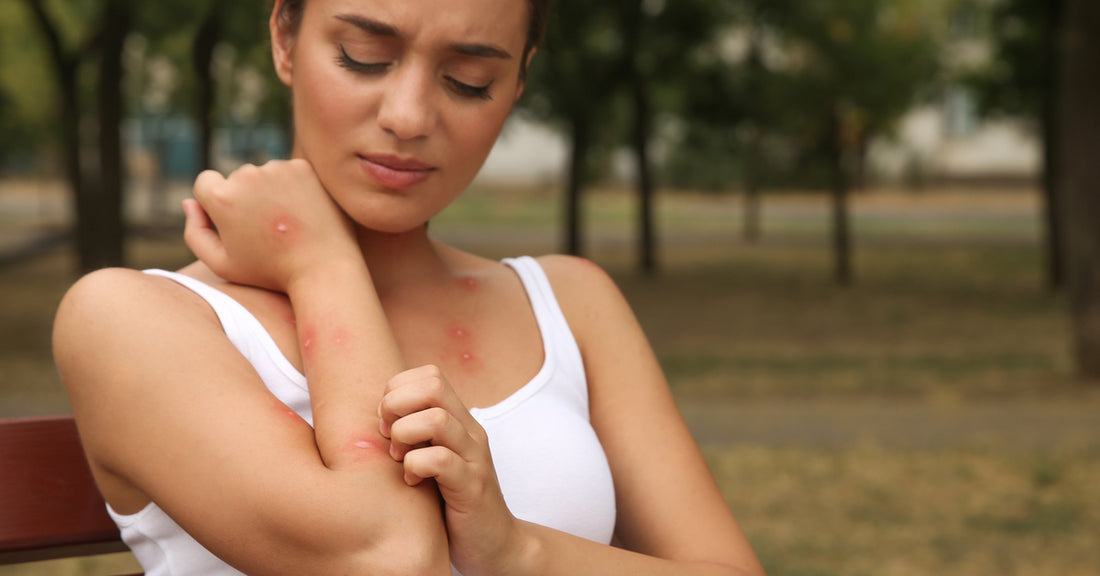 A woman sitting on a bench outside. She is scratching red bug bites on her arm and has a concerned look on her face.